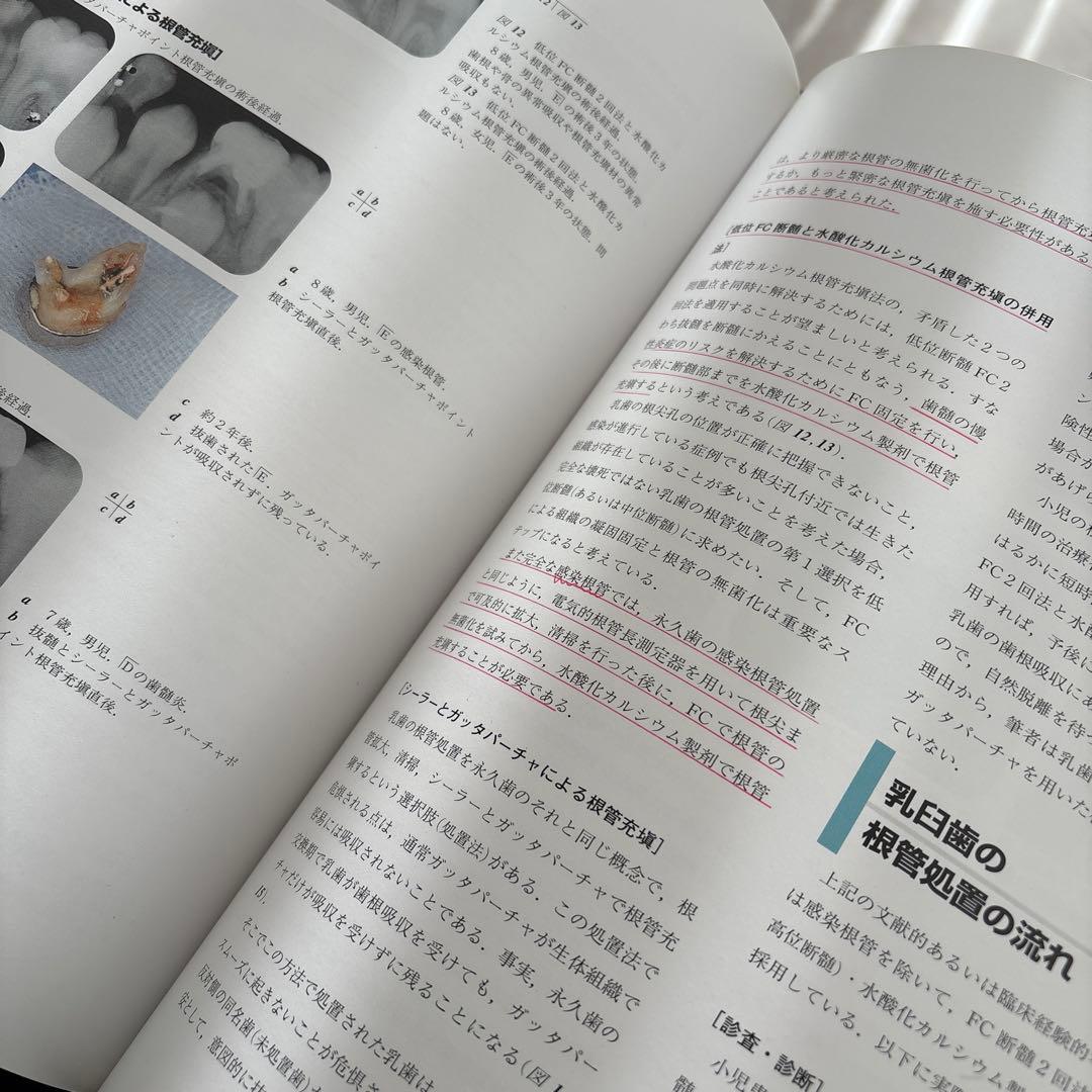 治療の歯内療法 カラーアトラス